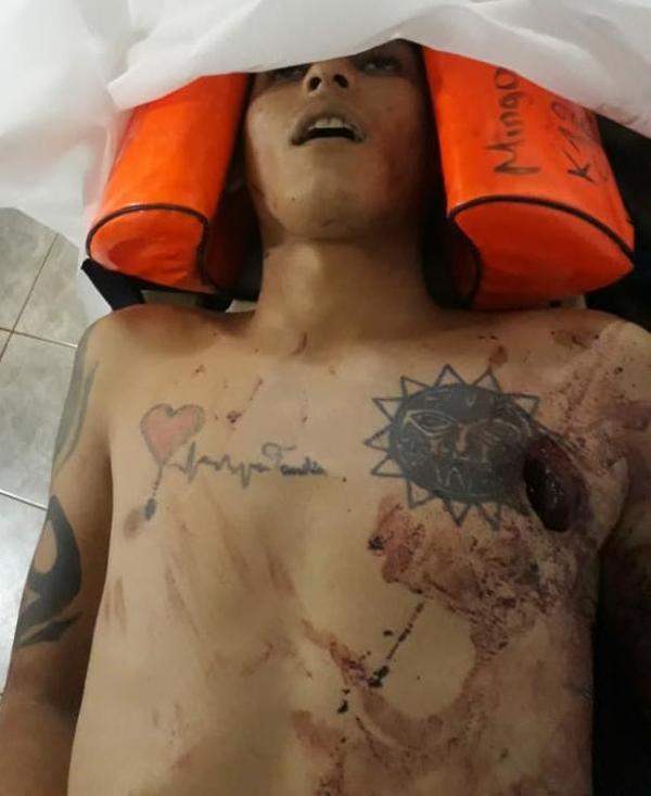Muere apuñalado por su amigo de tragos