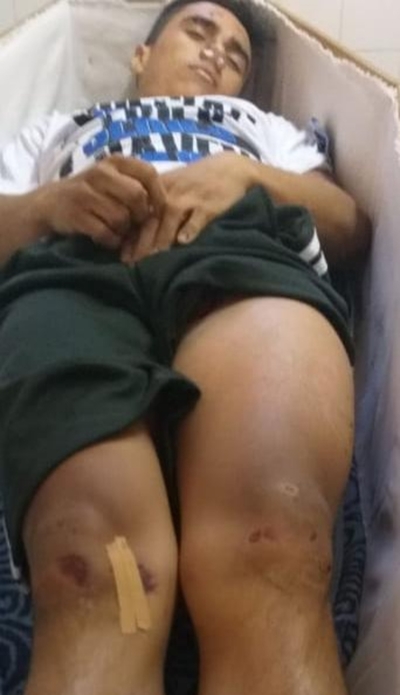 Joven muere desagrado tras ser baleado en el muslo luego de incidente en cancha de vóley – Diario TNPRESS