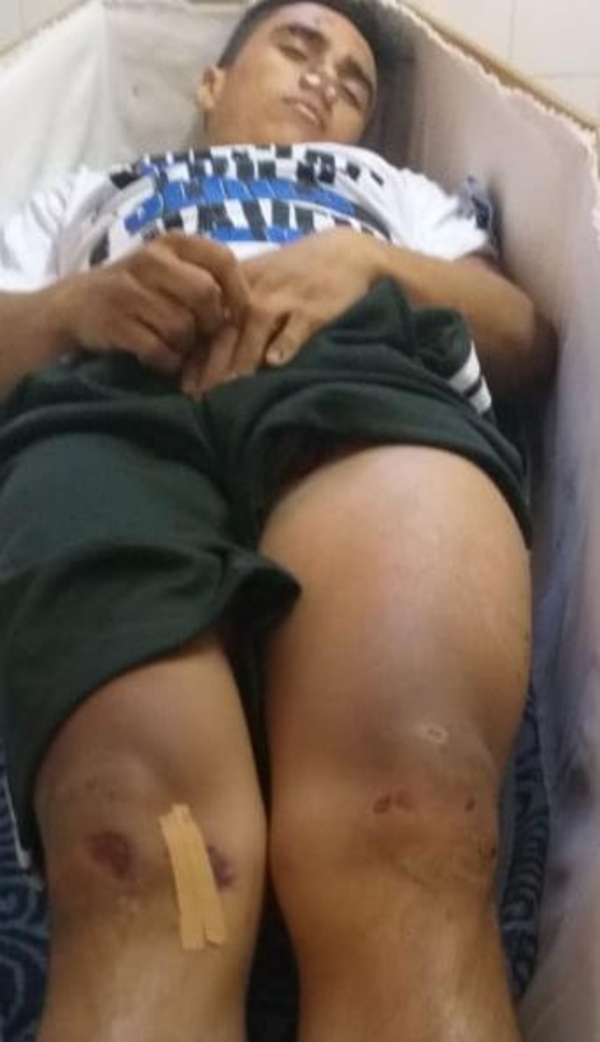 Joven muere desagrado tras ser baleado en el muslo luego de incidente en cancha de vóley – Diario TNPRESS