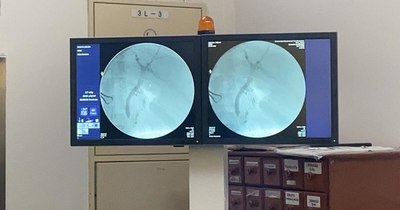 La Nación / Realizan con éxito inédita cirugía en hospital de Pedro Juan Caballero