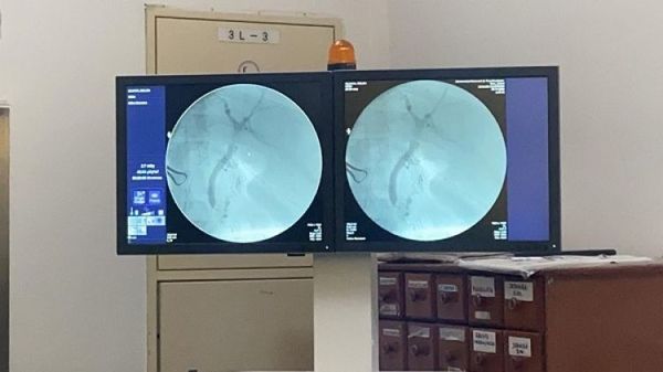 Realizan primera cirugía exitosa con colangiografía en el Hospital Regional de Pedro Juan