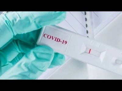 Funcionarios de Salud verificarán laboratorio de Itapúa ante dudas en resultados de test de COVID