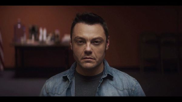 Tiziano Ferro: Me encanta la idea de convertir una cicatriz en un superpoder - Música - ABC Color