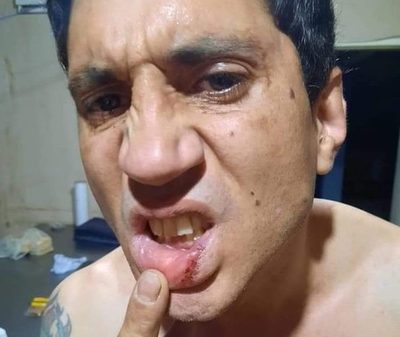 Mujer celosa “molió” a golpes a su pareja y éste la denunció
