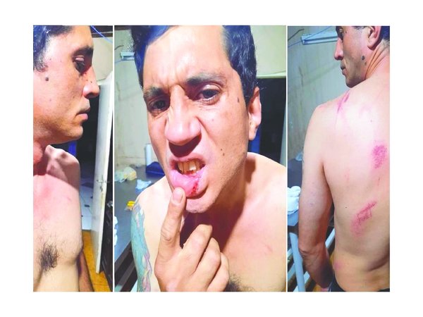 Garroteado por su doña en un ataque de celos