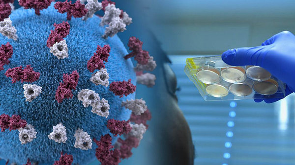 Paraguay recibirá tercera donación de test rápidos para el diagnóstico del coronavirus | .::Agencia IP::.