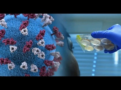 Paraguay recibirá tercera donación de test rápidos para el diagnóstico del coronavirus