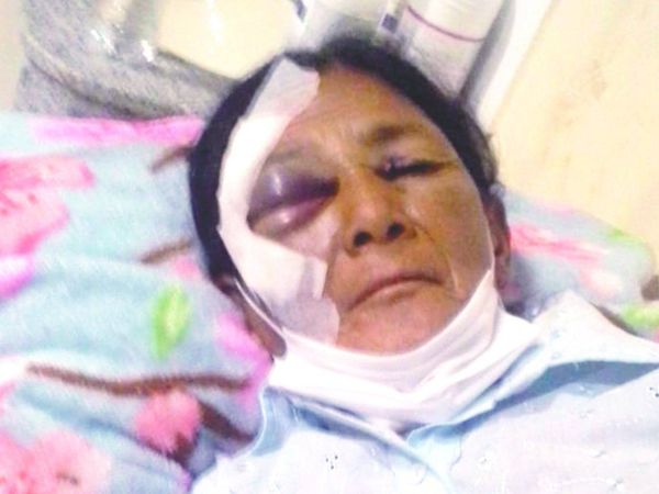 Golpeó a su exsuegra y luego le pidió perdón