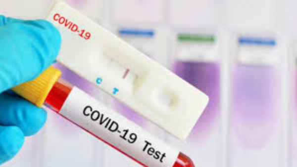 El país recibirá otra donación de test rápido para diagnóstico del Covid-19