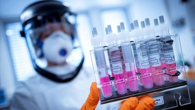 A días del anuncio de Pfizer, Rusia reveló que su vacuna contra el COVID-19 es 92% efectiva - Megacadena — Últimas Noticias de Paraguay