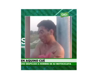 Violento asalto en Aquino-cué
