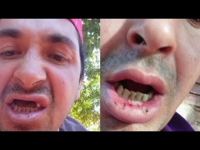 BRUTAL AGRESIÓN CONTRA UN HUMILDE TRABAJADOR EN EDELIRA