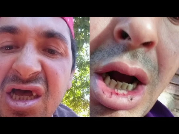 BRUTAL AGRESIÓN CONTRA UN HUMILDE TRABAJADOR EN EDELIRA