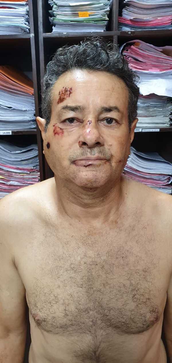 Brasileño herido durante enfrentamiento es un peligroso marginal con 14 antecedentes