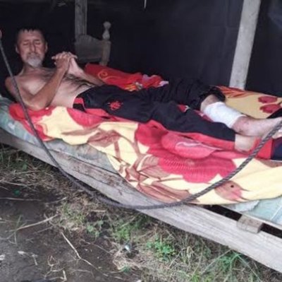Crónica / Ya le dieron atención médica al abuelito con la pierna agusanada