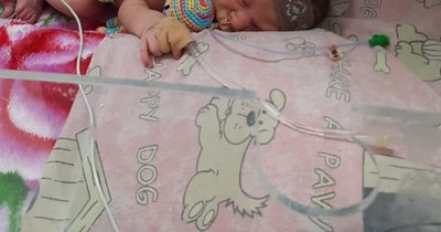 La Nación / “Embarazos en adolescentes se suman a factores que provocan nacimientos prematuros”, afirman