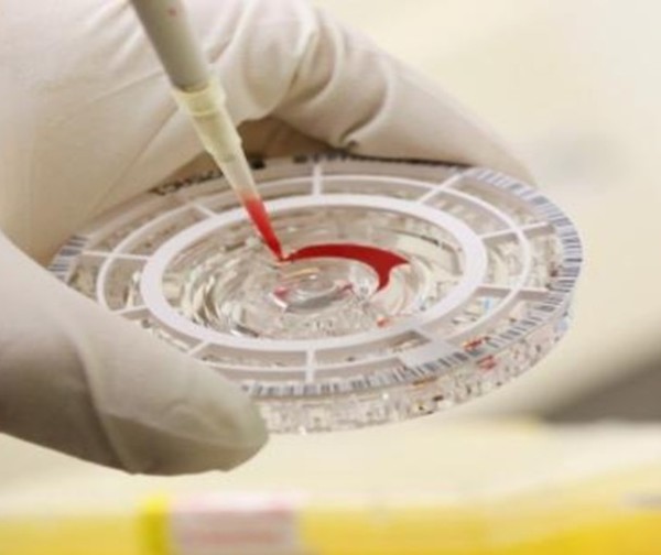 Nuevo virus denominado “Chapare”, genera alarma mundial