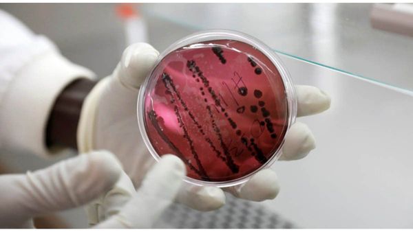 Alarma entre los científicos en Bolivia por la aparición de un nuevo virus con una letalidad similar al ébola » Ñanduti