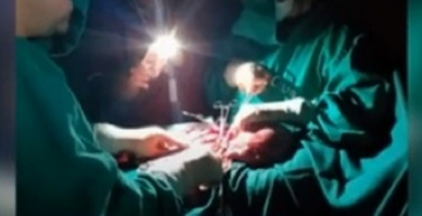Practicaron cesárea a la luz de una linterna en el Hospital de Caaguazú - Noticiero Paraguay