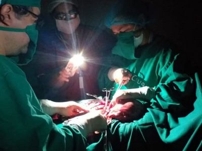 Cesárea a luz de linterna en el Hospital de Caaguazú