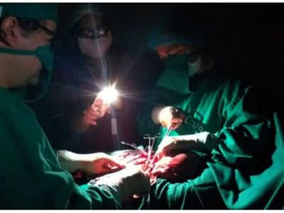 Cirugía con luz de un celular  en el Hospital Distrital de Caaguazú