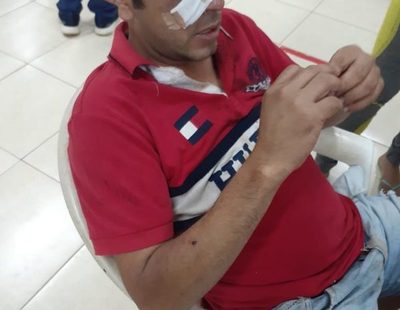Pelea entre «amigos de tragos» termina con un baleado