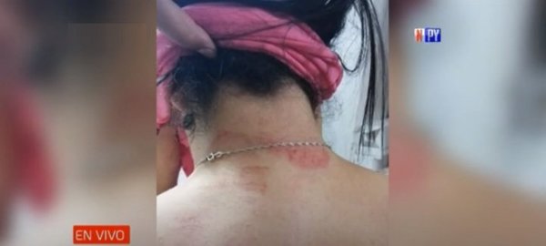 Mujer denuncia a su expareja por presunta agresión | Noticias Paraguay