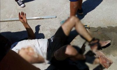 Albañil queda con graves quemaduras tras sufrir descarga eléctrica