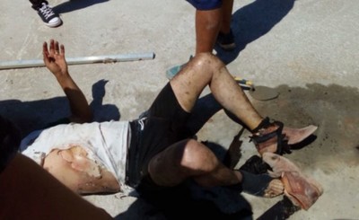 Obrero sufre descarga eléctrica y graves quemaduras