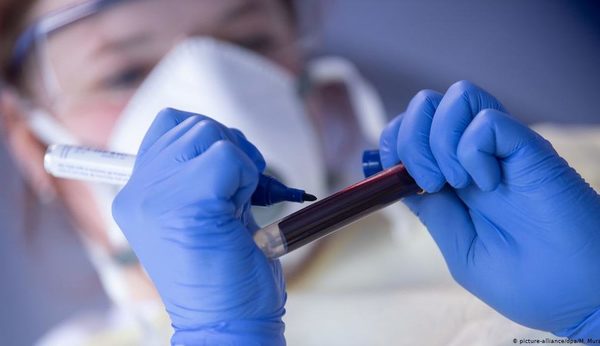 Coronavirus deja 11 personas fallecidas y 563 nuevos positivos