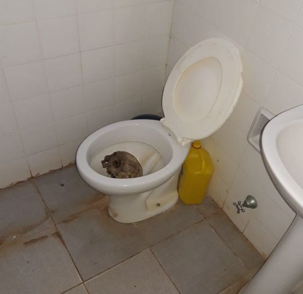 Hallan un cráneo en el inodoro del Centro de Salud de Caballero - Nacionales - ABC Color