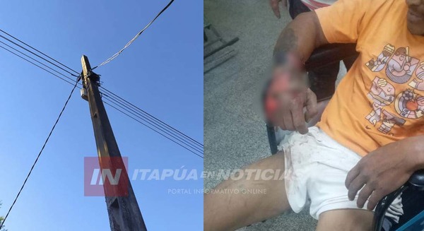 HOMBRE SUFRIÓ QUEMADURAS EN LOS BRAZOS TRAS DESCARGA ELÉCTRICA