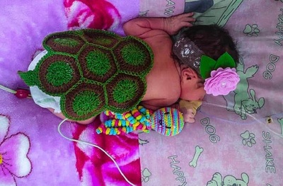 Terapia neonatal: Tortuguitas acompañan el apego a la vida