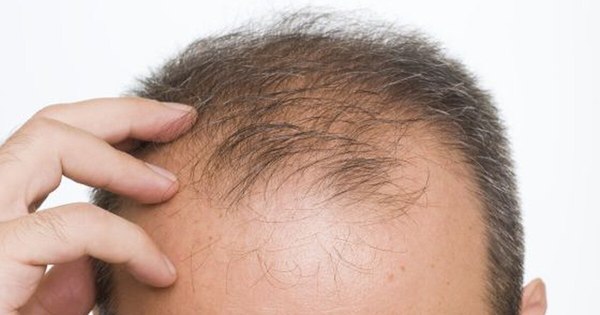 La Nación / Realizar chequeos para tratar la caída de cabello recomienda Clínica