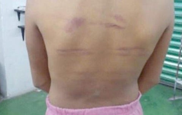 Presa por garrotear a su hija "por llegar tarde a casa" – Prensa 5