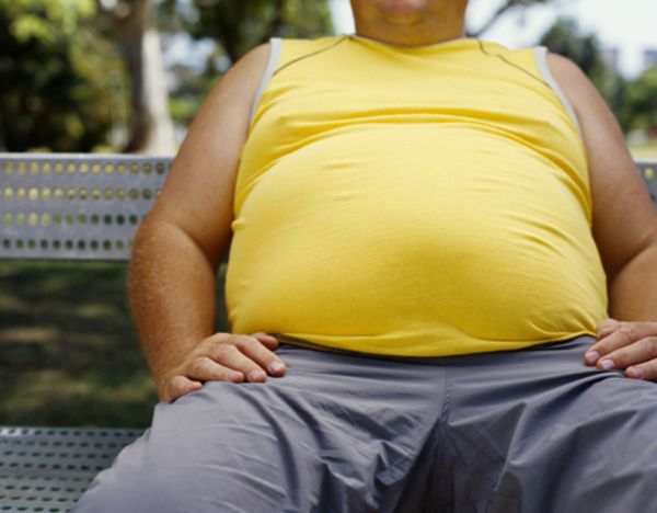 La obesidad es la principal causa de internación por COVID-19, refieren » Ñanduti