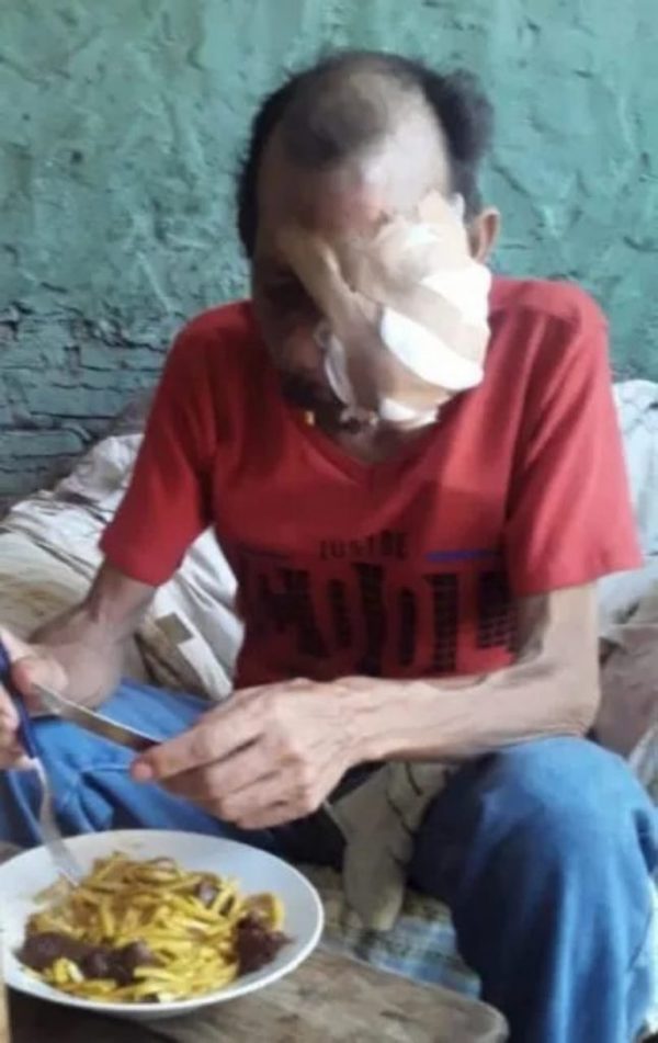 Hombre con cáncer necesita de una mano solidaria | Noticias Paraguay