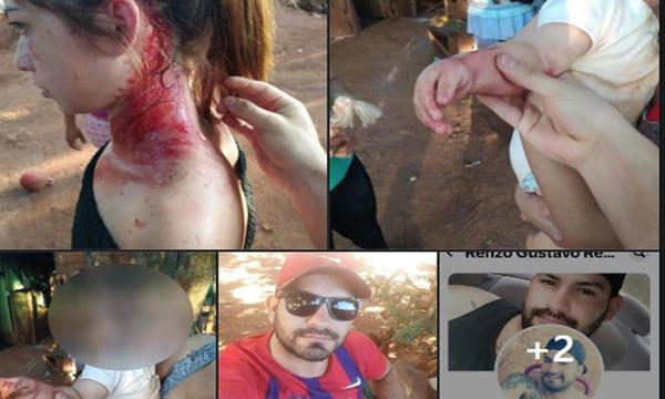 Mujer víctima de violencia pide auxilio a través de las redes sociales – Prensa 5