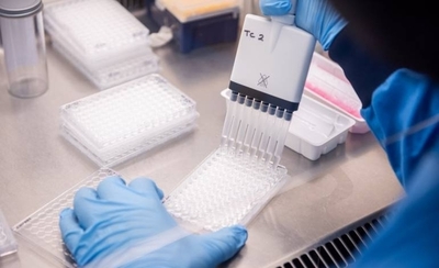 HOY / La vacuna de COVID-19 de AstraZeneca necesita un "estudio adicional", según el laboratorio