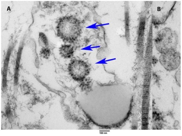 El coronavirus puede llegar a los testículos, según estudio
