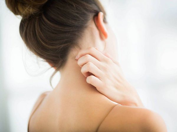 Dermatitis atópica empeora por medidas de higiene del Covid-19