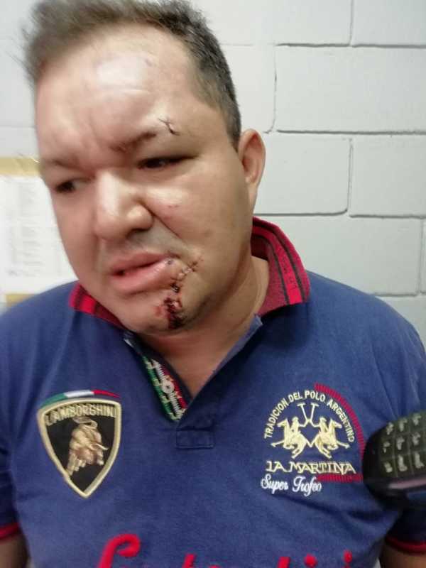 Le rebanan el rostro a carnicero con una botella rota durante pelea entre cuñados