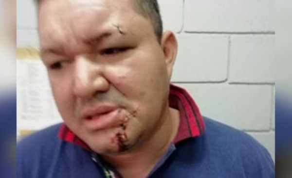 Atacado con una botella por su cuñada y concuñado