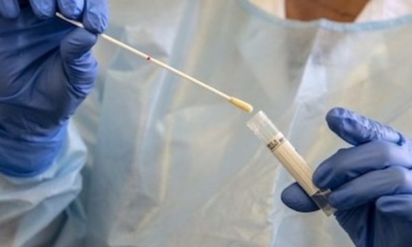Covid-19: 16 muertos y 919 positivos y 745 internados por el virus vai
