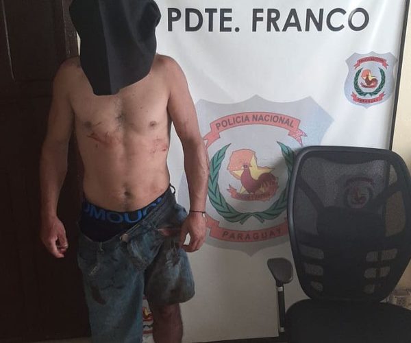 Detienen a presunto «jakare», fue pillado y alegó que se equivocó de casa
