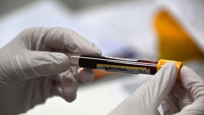 «No hay ninguna razón para dudar de los resultados»: Expertos británicos evalúan información sobre la vacuna rusa Sputnik V