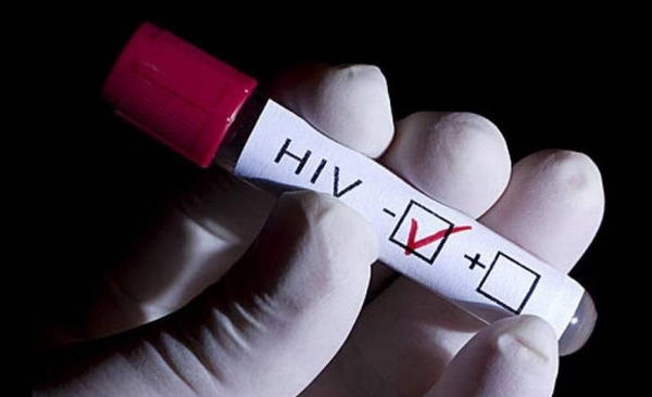 HOY / VIH: Una persona con carga viral indetectable no transmite el virus