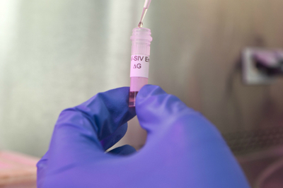 Rusia asegura tener prototipo de vacunas contra el VIH