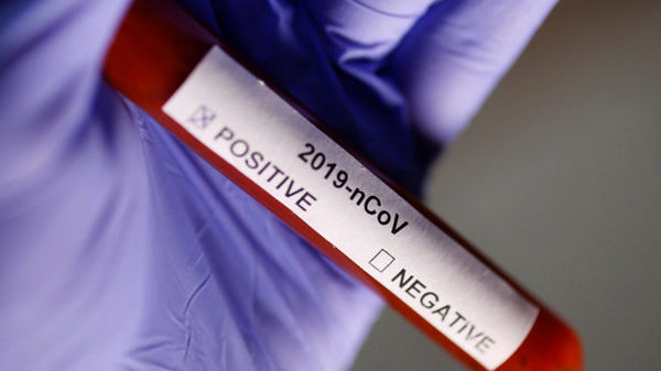 Coronavirus: 12 muertos, 1.033 positivos y 840 internados por el mba’e vai