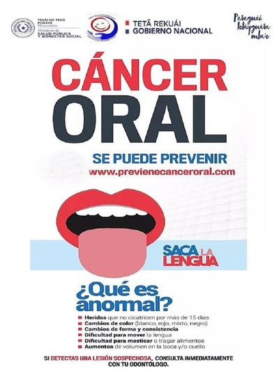 Cáncer oral: un mal que puede prevenirse  - Nacionales - ABC Color